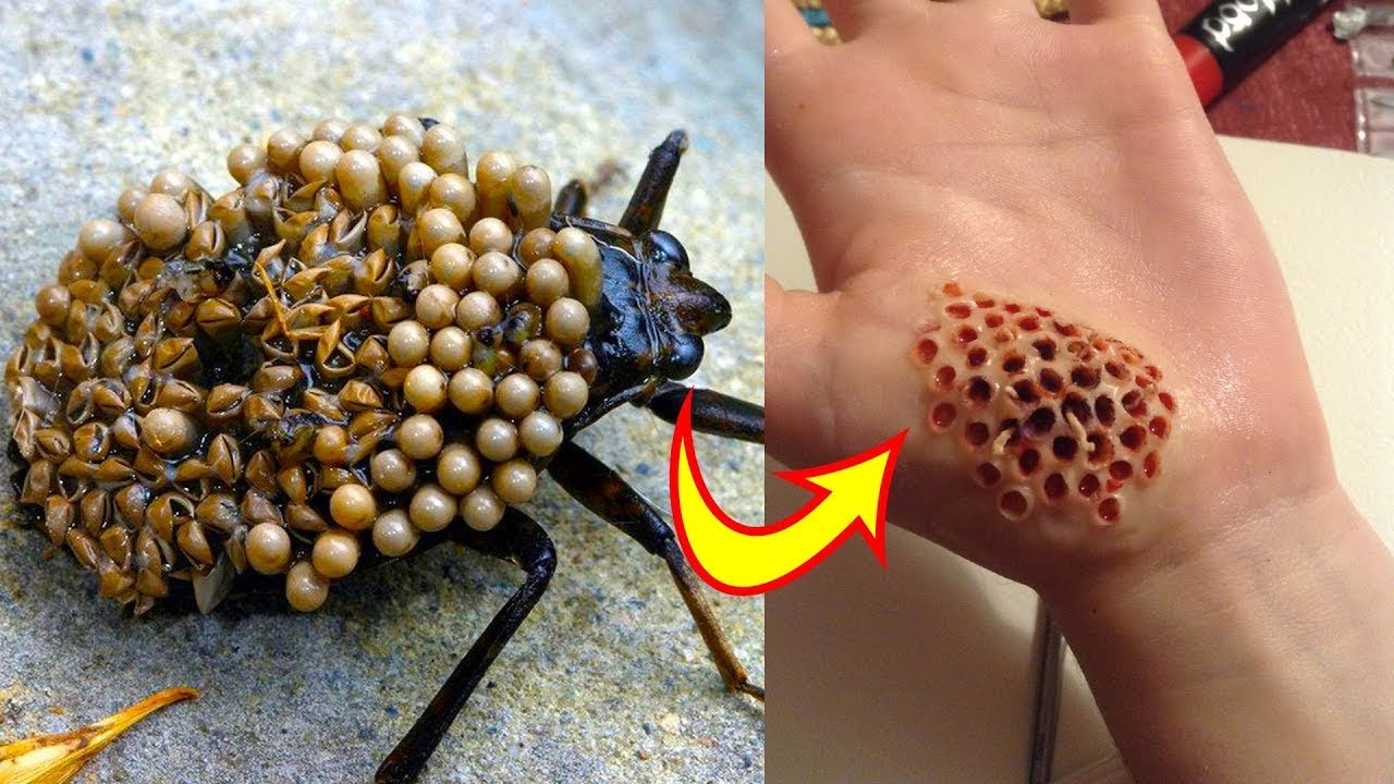 Top 10 gevaarlijkste insecten ter wereld 9