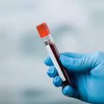 Nieuwe bloedtest kan 50 soorten kanker opsporen 17