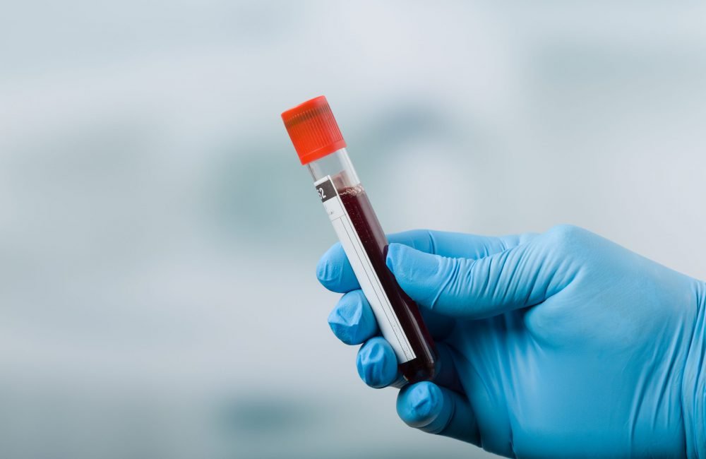 Nieuwe bloedtest kan 50 soorten kanker opsporen 13