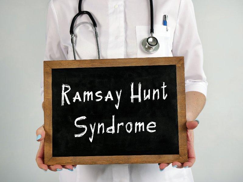 Justin Bieber ziek - Wat is het syndroom van Ramsay-Hunt? 16
